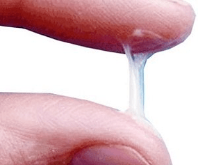 Wie sieht das Sekret eines Mannes normalerweise aus